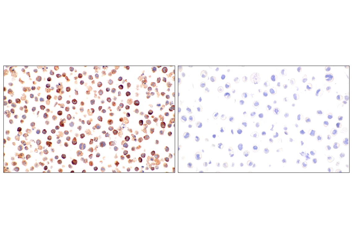 Immunohistochemistry Image 15: Eosinophil cationic protein (E6U5M) Rabbit Monoclonal Antibody (BSA and Azide Free)