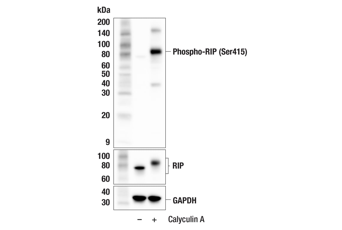 Western Blotting Image 3: Phospho-RIP (Ser415) (F1U7B) Rabbit Monoclonal Antibody