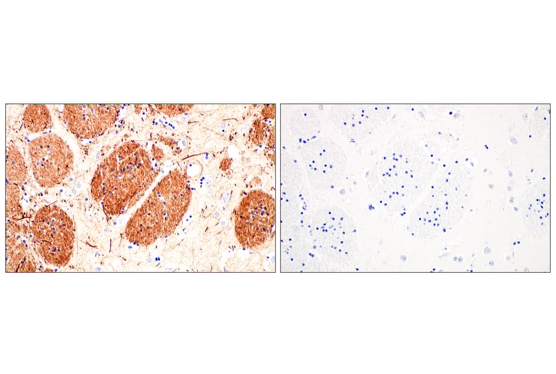 Immunohistochemistry Image 6: Neurofilament-M (E7Y8W) Mouse Monoclonal Antibody