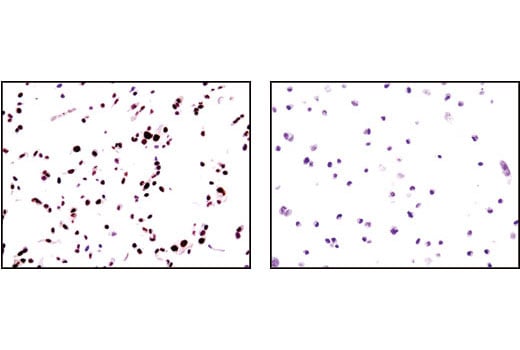 Immunohistochemistry Image 2: Progesterone Receptor A/B (C89F7) Rabbit Monoclonal Antibody