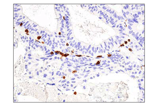 Immunohistochemistry Image 2: CD3 epsilon (D7A6E<sup>™</sup>) Rabbit Monoclonal Antibody (BSA and Azide Free)