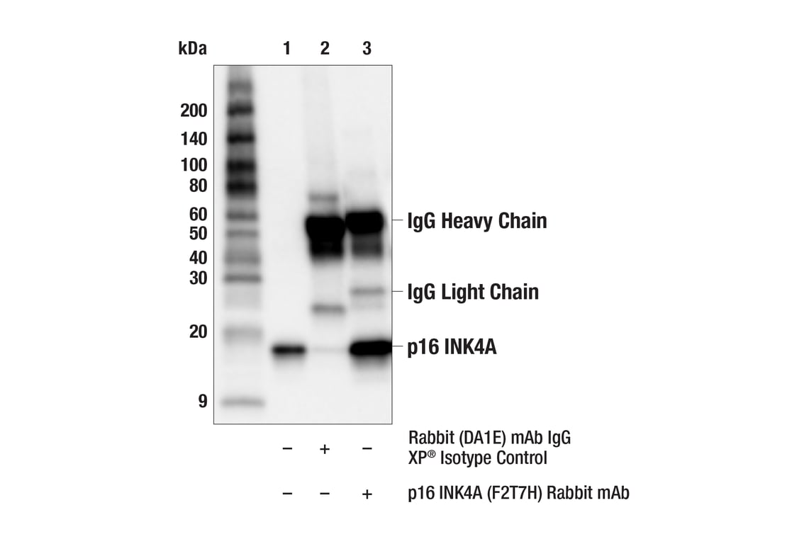 Immunoprecipitation Image 1: p16 INK4A (F2T7H) Rabbit Monoclonal Antibody