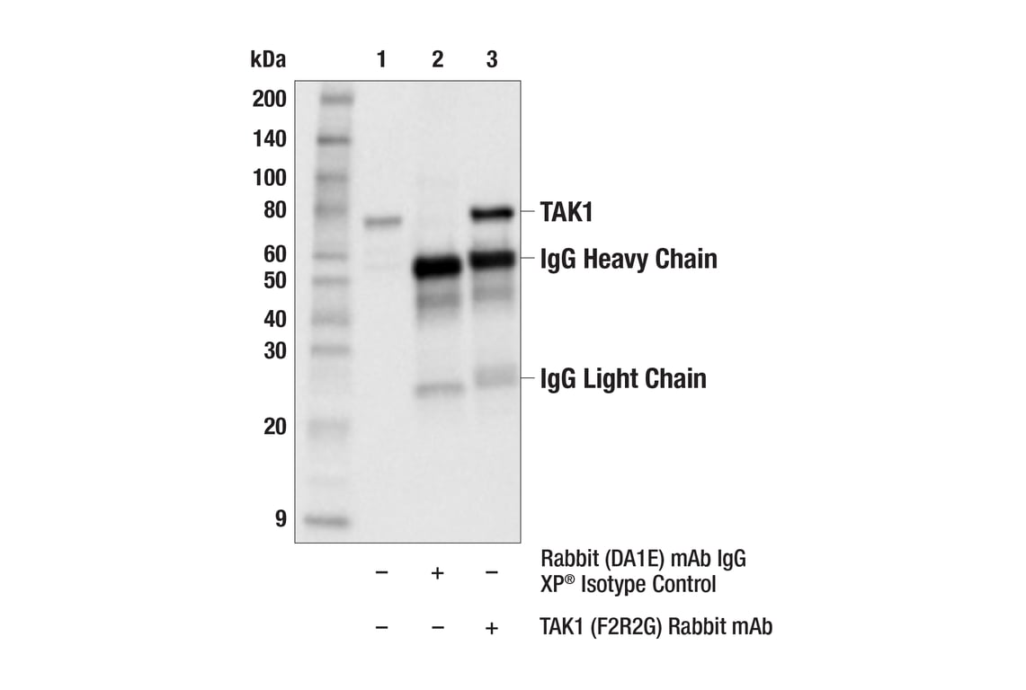 Immunoprecipitation Image 1: TAK1 (F2R2G) Rabbit Monoclonal Antibody