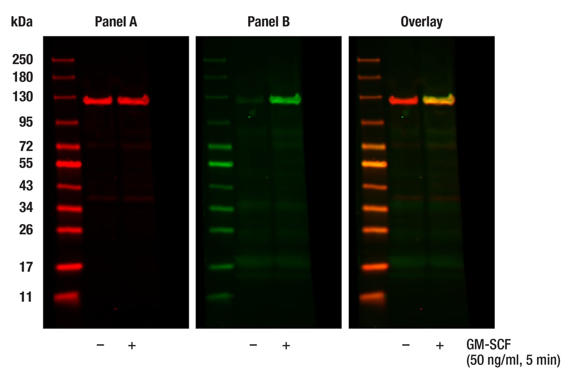 Western Blotting Image 1: Phospho-Jak2 (Tyr1008) (D4A8) Rabbit Monoclonal Antibody