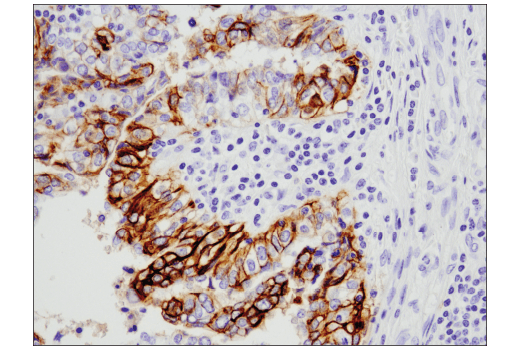 Immunohistochemistry Image 2: NCAM-L1 (D5D3K) Rabbit Monoclonal Antibody