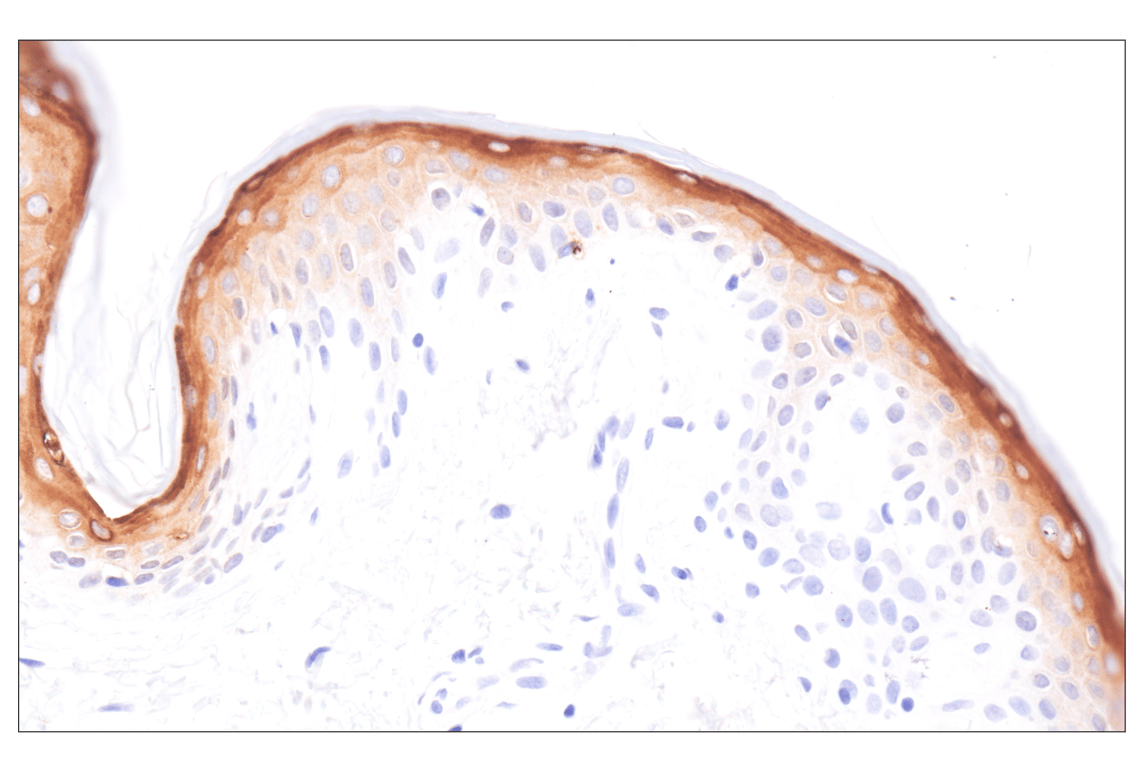 Immunohistochemistry Image 7: Involucrin (F9C3C) Rabbit Monoclonal Antibody