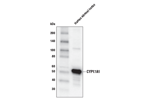 Western Blotting Image 2: CYP17A1 (E6Y3S) Rabbit Monoclonal Antibody