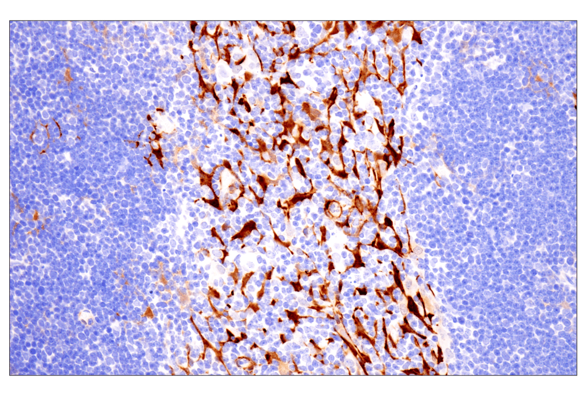 Immunohistochemistry Image 13: Transgelin/TAGLN (F3B7H) Rabbit Monoclonal Antibody