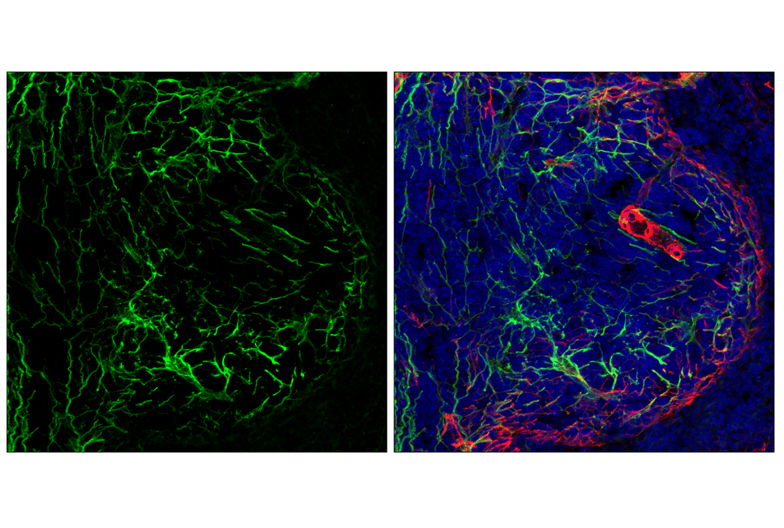 Immunofluorescence Image 1: COL1A1 (E8F4L) Rabbit Monoclonal Antibody