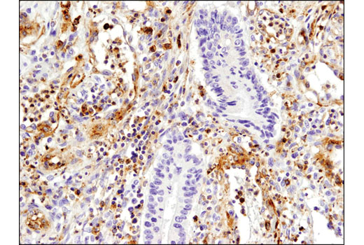 Immunohistochemistry Image 4: VISTA (D1L2G<sup>™</sup>) Rabbit Monoclonal Antibody (BSA and Azide Free)