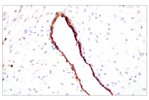 Immunohistochemistry Image 4: Nestin (E4O9E) Rabbit Monoclonal Antibody (BSA and Azide Free)