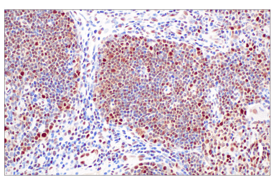Immunohistochemistry Image 4: FKBP5 (F1G3I) Rabbit Monoclonal Antibody