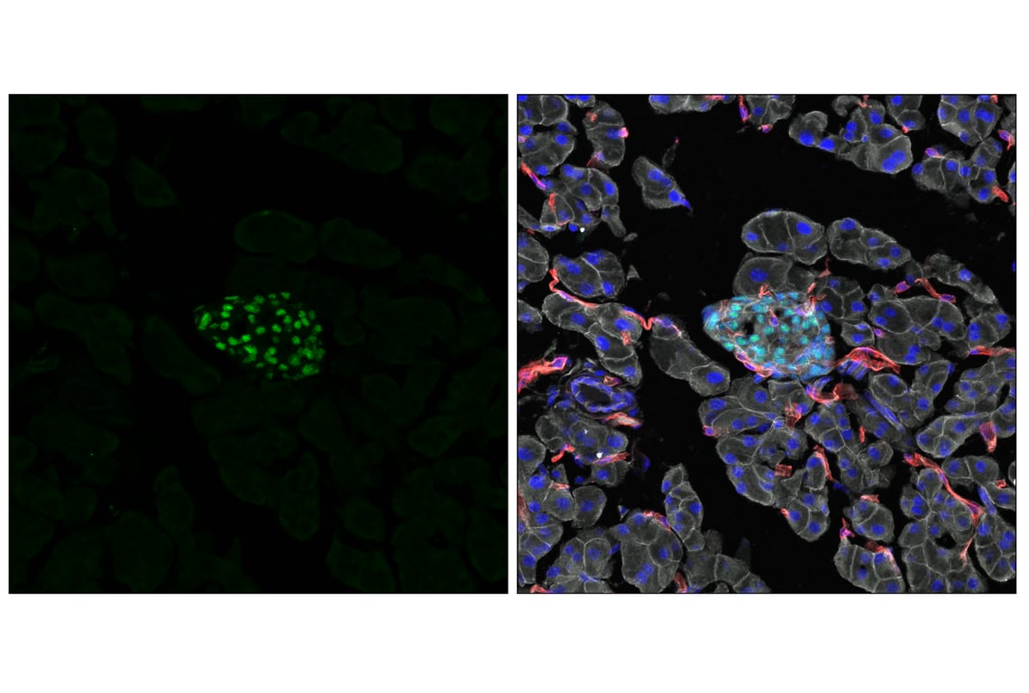 Immunofluorescence Image 1: NeuroD1 (E3E4F) Rabbit Monoclonal Antibody