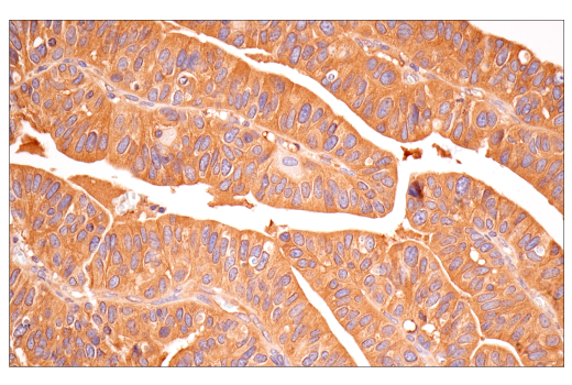Immunohistochemistry Image 1: B-Raf (E3T5C) Mouse Monoclonal Antibody
