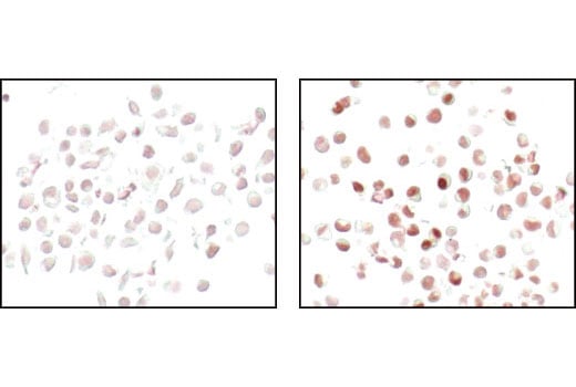 Immunohistochemistry Image 3: FosB (5G4) Rabbit mAb