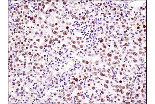 undefined Image 17: PBAF Complex Antibody Sampler Kit