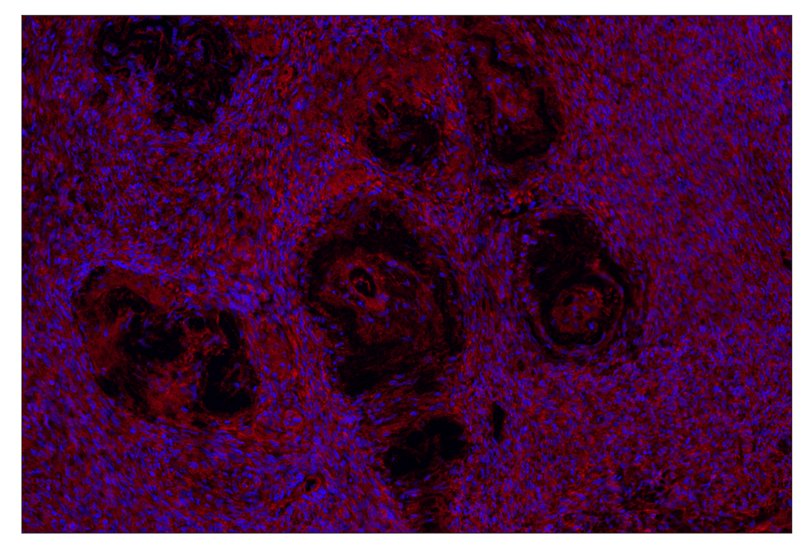 Immunohistochemistry Image 2: FGF Receptor 1 (D8E4) & CO-0156-488 SignalStar<sup>®</sup> Oligo-Antibody Pair