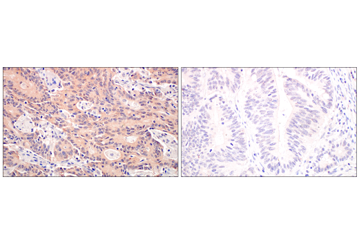 Immunohistochemistry Image 1: B-Raf (V600E Mutant) (IHC600) Mouse Monoclonal Antibody