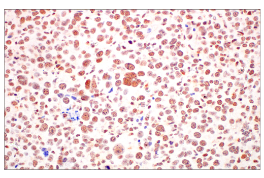 Immunohistochemistry Image 11: TIF1α/TRIM24 (E9T3N) Rabbit mAb