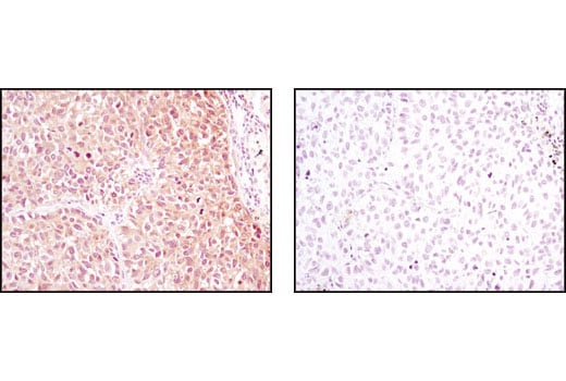 Immunohistochemistry Image 3: NME1/NDKA (D98) Antibody