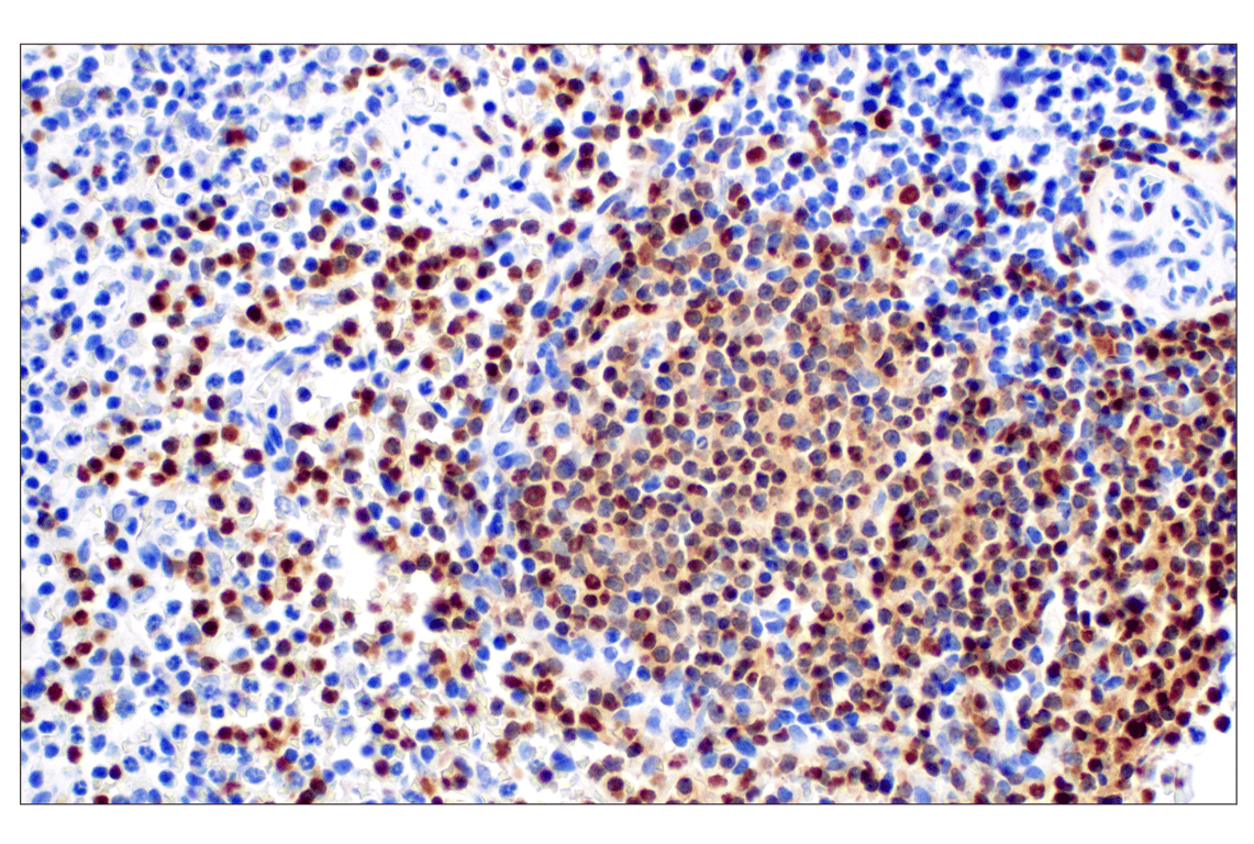 Immunohistochemistry Image 4: PAX5 (D7H5X) Rabbit Monoclonal Antibody (BSA and Azide Free)