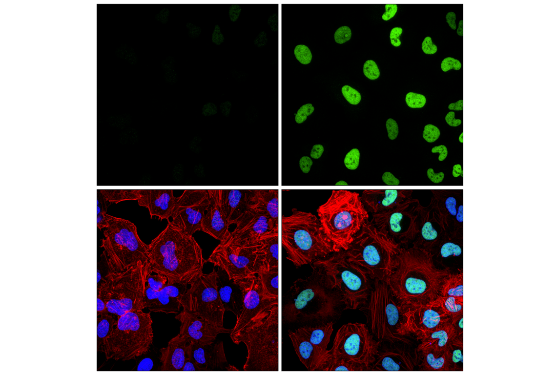 Immunofluorescence Image 1: FRA1 (F2C9L) Rabbit Monoclonal Antibody