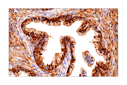 undefined Image 28: Ferroptosis Antibody Sampler Kit