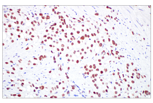 Immunohistochemistry Image 6: TIF1 alpha/TRIM24 (E9T3N) Rabbit Monoclonal Antibody