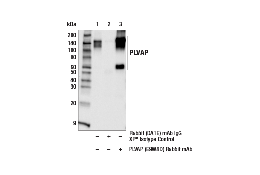 Immunoprecipitation Image 1: PLVAP (E9W8D) Rabbit Monoclonal Antibody
