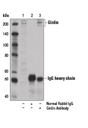 Immunoprecipitation Image 1: Girdin Antibody