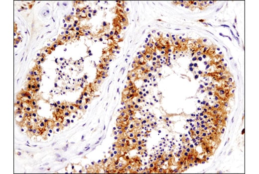 Immunohistochemistry Image 5: IGF-II Receptor/CI-M6PR (D8Z3J) Rabbit Monoclonal Antibody