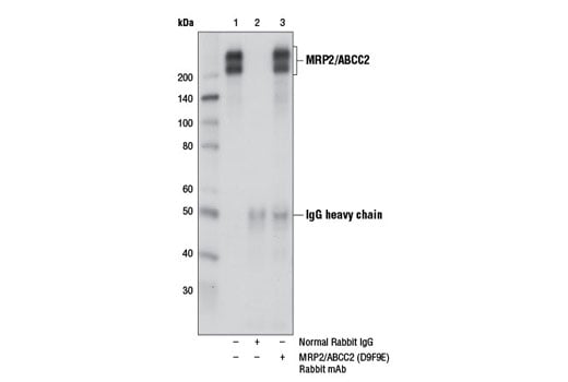 Immunoprecipitation Image 1: MRP2/ABCC2 (D9F9E) Rabbit Monoclonal Antibody