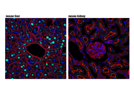 Immunofluorescence Image 1: GCKR (D1W9P) Rabbit Monoclonal Antibody