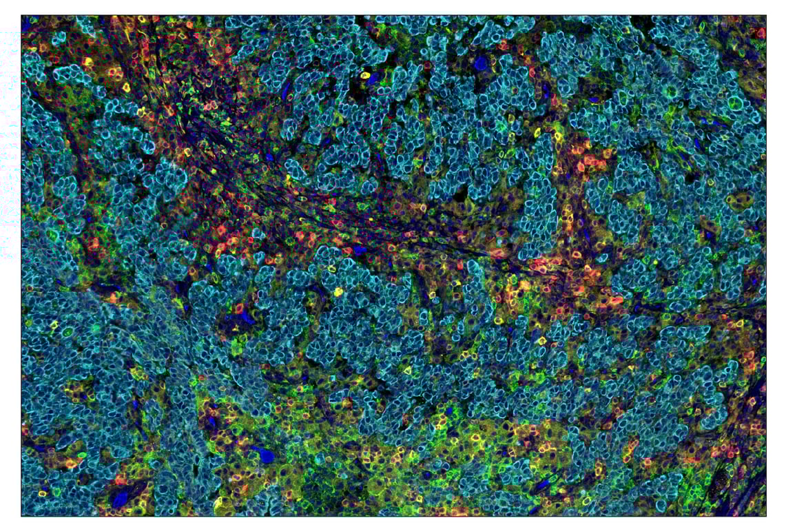 Immunohistochemistry Image 1: ICOS (D1K2T<sup>™</sup>) & CO-0027-488 SignalStar<sup>™</sup> Oligo-Antibody Pair