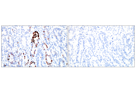 Immunohistochemistry Image 9: MAGE-C2/CT10 (E7B8D) Rabbit Monoclonal Antibody