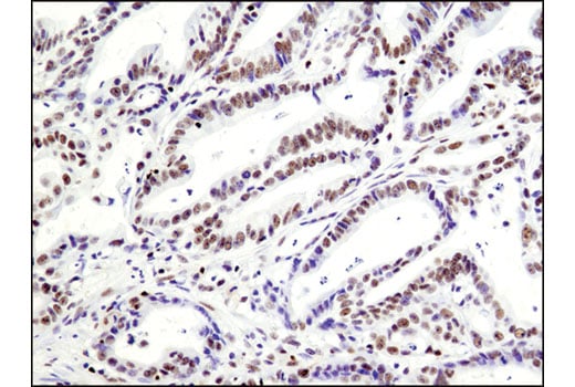 undefined Image 17: Notch Activated Targets Antibody Sampler Kit