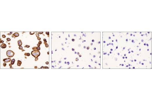 Immunohistochemistry Image 4: FGF Receptor 2 (D4L2V) Rabbit Monoclonal Antibody (BSA and Azide Free)