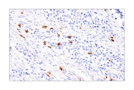 undefined Image 43: NETosis Antibody Sampler Kit