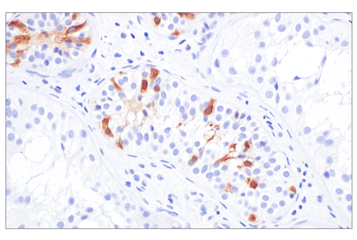 Immunohistochemistry Image 6: p16 INK4A (F9T1L) Rabbit Monoclonal Antibody