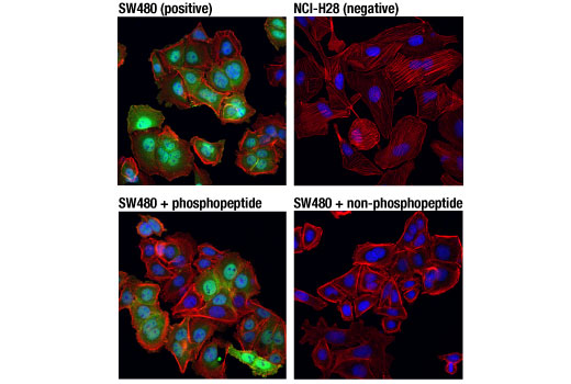 Non-phospho (Active) β-Catenin (Ser45) (D2U8Y) XP® Rabbit Non-phospho (Active) β-Catenin (Ser45) (D2U8Y) XP® Rabbit