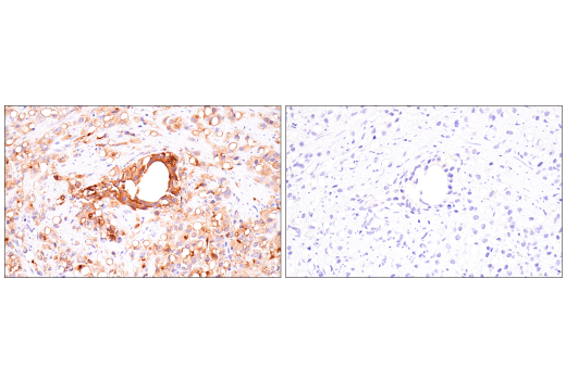 Immunohistochemistry Image 8: Rab27B (E4V3O) Rabbit Monoclonal Antibody