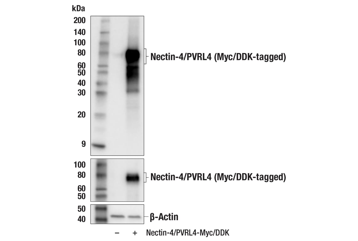 Western Blotting Image 2: Nectin-4/PVRL4 (E5Q1W) Rabbit Monoclonal Antibody