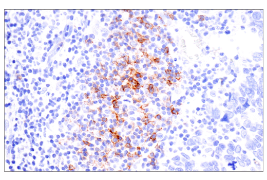 Immunohistochemistry Image 2: CD23 (E1R4G) Rabbit Monoclonal Antibody (BSA and Azide Free)