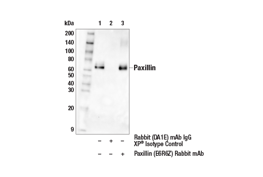 Immunoprecipitation Image 1: Paxillin (E6R6Z) Rabbit Monoclonal Antibody