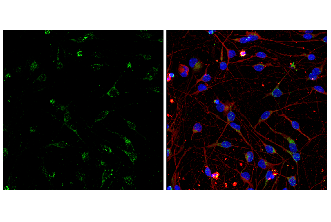 undefined Image 47: Electron Transport Chain (Complex II, III, IV) Antibody Sampler Kit