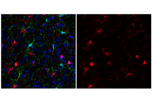 Immunofluorescence Image 3: S100B (E7C3A) Rabbit Monoclonal Antibody (BSA and Azide Free)