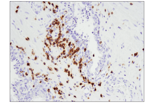 Immunohistochemistry Image 4: CD5 (E8X3S) XP<sup>®</sup> Rabbit mAb