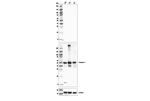undefined Image 15: Mouse Reactive Inflammasome Antibody Sampler Kit