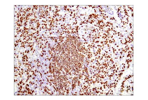 Immunohistochemistry Image 2: PAX5 (D7H5X) Rabbit Monoclonal Antibody (BSA and Azide Free)