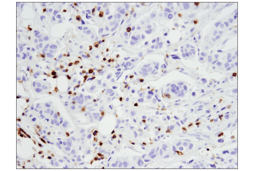 Immunohistochemistry Image 1: CD5 (E8X3S) Rabbit Monoclonal Antibody